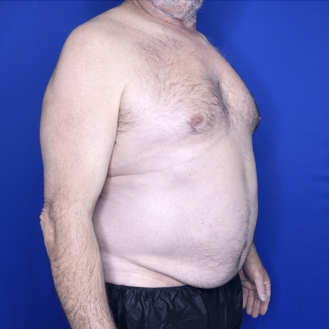 Before & After Photos: Plastic Surgery